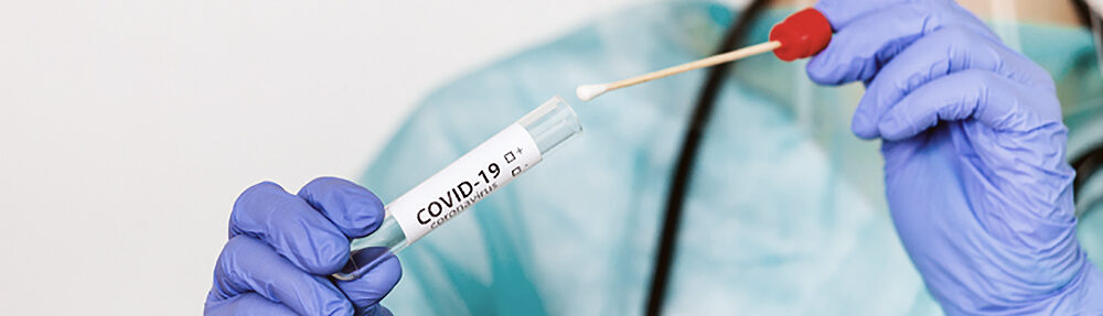 most covid tests are actually just pcr tests and they dont work
